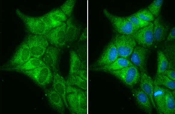 Immunocytochemistry/ Immunofluorescence: Cytochrome b5 type A Antibody [NBP2-14923] - Cytochrome b5 type A antibody detects Cytochrome b5 type A protein at cytoplasm by immunofluorescent analysis.Sample: MDCK cells were fixed in 4% paraformaldehyde at RT for 15 min.Green: Cytochrome b5 type A stained by Cytochrome b5 type A antibody (NBP2-14923) diluted at 1:500.Blue: Hoechst 33342 staining.