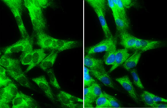 Immunocytochemistry/ Immunofluorescence: Cytochrome b5 type A Antibody [NBP2-14923] - Cytochrome b5 type A antibody detects Cytochrome b5 type A protein at cytoplasm by immunofluorescent analysis.Sample: PG-4 cells were fixed in 4% paraformaldehyde at RT for 15 min.Green: Cytochrome b5 type A stained by Cytochrome b5 type A antibody (NBP2-14923) diluted at 1:500.Blue: Hoechst 33342 staining.