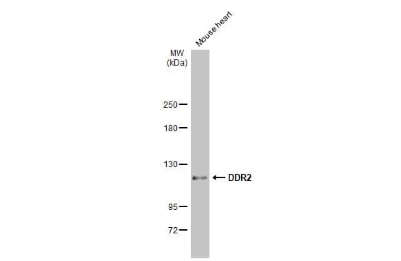 Western Blot: DDR2 Antibody [NBP2-14926] - Mouse tissue extract (50 ug) was separated by 5% SDS-PAGE, and the membrane was blotted with DDR2 antibody [C2C3], C-term (NBP2-14926) diluted at 1:1000. The HRP-conjugated anti-rabbit IgG antibody  was used to detect the primary antibody.