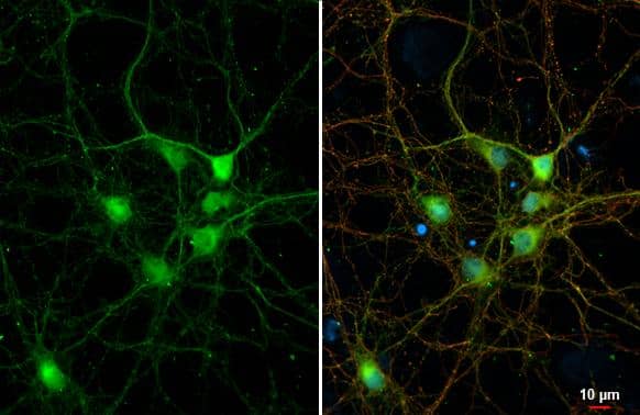 DDR2 antibody [C2C3], C-term detects DDR2 protein at cell membrane by immunofluorescent analysis.Sample: DIV9 rat E18 primary cortical neuron and glia cells were fixed in 4% paraformaldehyde at RT for 15 min.Green: DDR2 stained by DDR2 antibody [C2C3], C-term (NBP2-14926) diluted at 1:250.Red: Tau, an Axon marker, stained by Tau antibody [GT287]  diluted at 1:500.Blue: Fluoroshield with DAPI . 