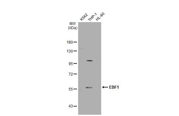 Western Blot: EBF-1 Antibody [NBP2-14937] - Various whole cell extracts (30 ug) were separated by 7.5% SDS-PAGE, and the membrane was blotted with EBF-1 antibody (NBP2-14937) diluted at 1:1000. The HRP-conjugated anti-rabbit IgG antibody  was used to detect the primary antibody.