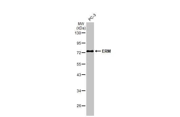 Western Blot ETV5/ERM Antibody - BSA Free