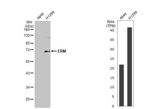 Western Blot ETV5/ERM Antibody - BSA Free