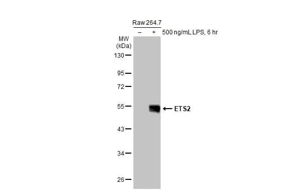 Western Blot: ETS2 Antibody [NBP2-14951] - Untreated (-) and treated (+) Raw 264.7 whole cell extracts (30 ug) were separated by 10% SDS-PAGE, and the membrane was blotted with ETS2 antibody (NBP2-14951) diluted at 1:500. The HRP-conjugated anti-rabbit IgG antibody  was used to detect the primary antibody.