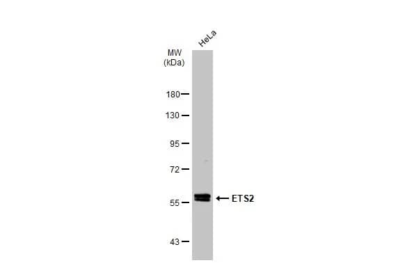 Western Blot: ETS2 Antibody [NBP2-14951] - Whole cell extract (30 ug) was separated by 7.5% SDS-PAGE, and the membrane was blotted with ETS2 antibody (NBP2-14951) diluted at 1:500. The HRP-conjugated anti-rabbit IgG antibody  was used to detect the primary antibody.