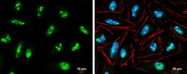 Immunocytochemistry/ Immunofluorescence Exosome component 5 Antibody