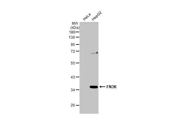Various whole cell extracts (30 ug) were separated by 10% SDS-PAGE, and the membrane was blotted with FN3K antibody [N1C3-2] (NBP2-14959) diluted at 1:1000. The HRP-conjugated anti-rabbit IgG antibody  was used to detect the primary antibody. 