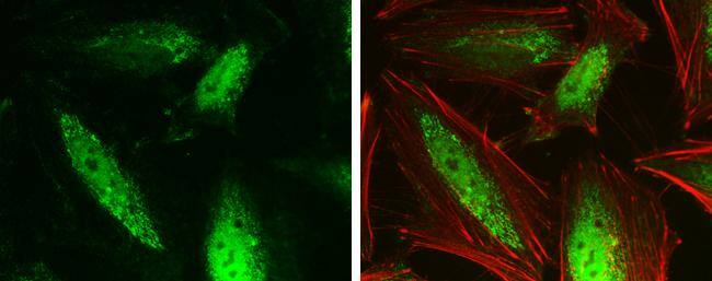 GPS2 antibody detects GPS2 protein at cytoplasm and nucleus by immunofluorescent analysis.Sample: HeLa cells were fixed in 4% paraformaldehyde at RT for 15 min.Green: GPS2 protein stained by GPS2 antibody (NBP2-14970) diluted at 1:500.Red: Phalloidin, a cytoskeleton marker, diluted at 1:200. 