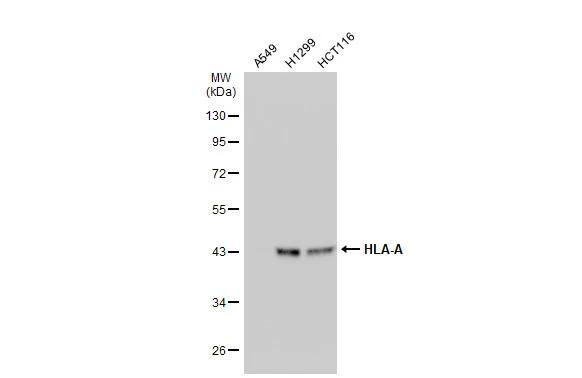 Various whole cell extracts (30 ug) were separated by 10% SDS-PAGE, and the membrane was blotted with HLA-A antibody [N1C2] (NBP2-14982) diluted at 1:5000. The HRP-conjugated anti-rabbit IgG antibody  was used to detect the primary antibody. 