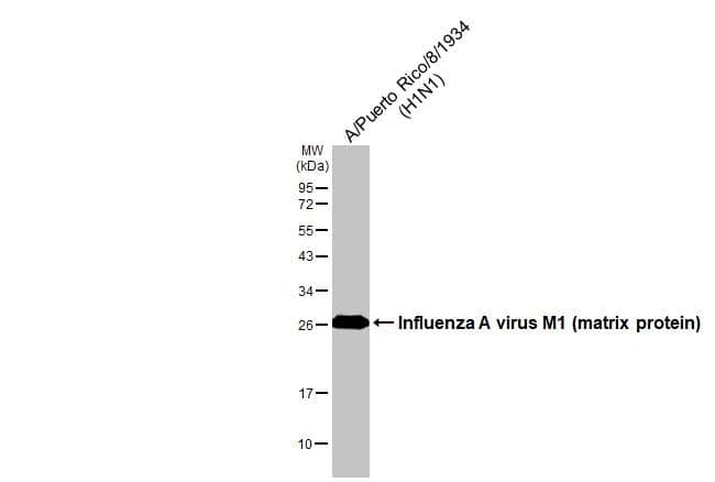 Influenza A (H1N1) viral lysate (0.5 ug) was separated by 12% SDS-PAGE, and the membrane was blotted with Influenza A virus M1 (matrix protein) antibody (NBP2-14995) diluted at 1:5000. The HRP-conjugated anti-rabbit IgG antibody  was used to detect the primary antibody. 