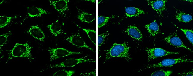 Immunocytochemistry/ Immunofluorescence: ISCU Antibody [NBP2-14998] - ISCU antibody [N1C3] detects ISCU protein at mitochondria by immunofluorescent analysis.Sample: HeLa cells were fixed in ice-cold MeOH for 5 min.Green: ISCU stained by ISCU antibody [N1C3] (NBP2-14998) diluted at 1:500.Blue: Hoechst 33342 staining.