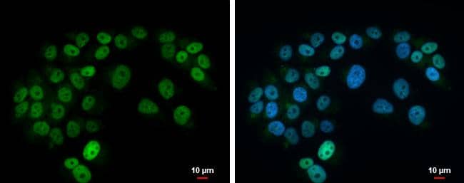 Immunocytochemistry/ Immunofluorescence Islet-1 Antibody - BSA Free