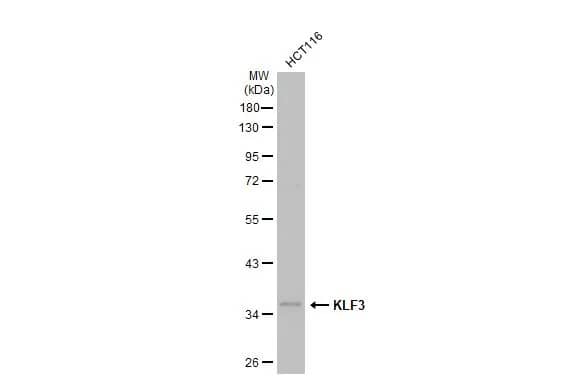 Western Blot: KLF3 Antibody [NBP2-15008] - Whole cell extract (30 ug) was separated by 10% SDS-PAGE, and the membrane was blotted with KLF3 antibody [N3C3] (NBP2-15008) diluted at 1:1000. The HRP-conjugated anti-rabbit IgG antibody  was used to detect the primary antibody, and the signal was developed with Trident ECL plus-Enhanced.