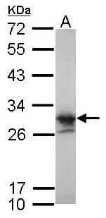 Western Blot: LIN7 Antibody [NBP2-15016] - Sample (30 ug of whole cell lysate)  A: zebrafish eye  12% SDS PAGE  NBP2-15016 diluted at 1:1000 