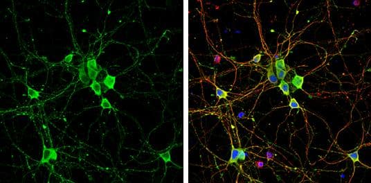 Immunocytochemistry/ Immunofluorescence Liprin alpha 2 Antibody - BSA Free