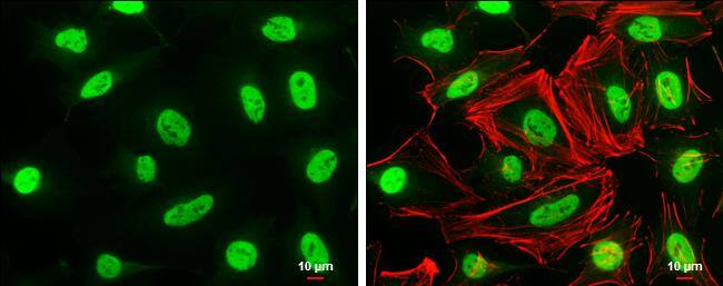 MAFG antibody detects MAFG protein at nucleus by immunofluorescent analysis.Sample: HeLa cells were fixed in 4% paraformaldehyde at RT for 15 min.Green: MAFG protein stained by MAFG antibody (NBP2-15019) diluted at 1:500.Red: phalloidin, a cytoskeleton marker, diluted at 1:50.Scale bar = 10 um. 
