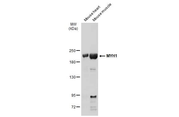 Western Blot: Myosin Heavy Chain 1 Antibody [NBP2-15029] - Various tissue extracts (50 ug) were separated by 5% SDS-PAGE, and the membrane was blotted with Myosin Heavy Chain 1 antibody [N1], N-term (NBP2-15029) diluted at 1:500. The HRP-conjugated anti-rabbit IgG antibody  was used to detect the primary antibody.