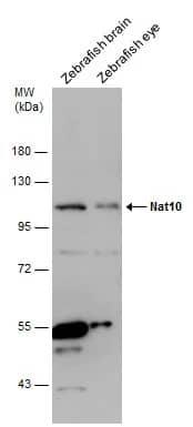 Western Blot: NAT10 Antibody [NBP2-15033] - Various tissue extracts (30 ug) were separated by 7.5% SDS-PAGE, and the membrane was blotted with NAT10 antibody (NBP2-15033) diluted at 1:500.