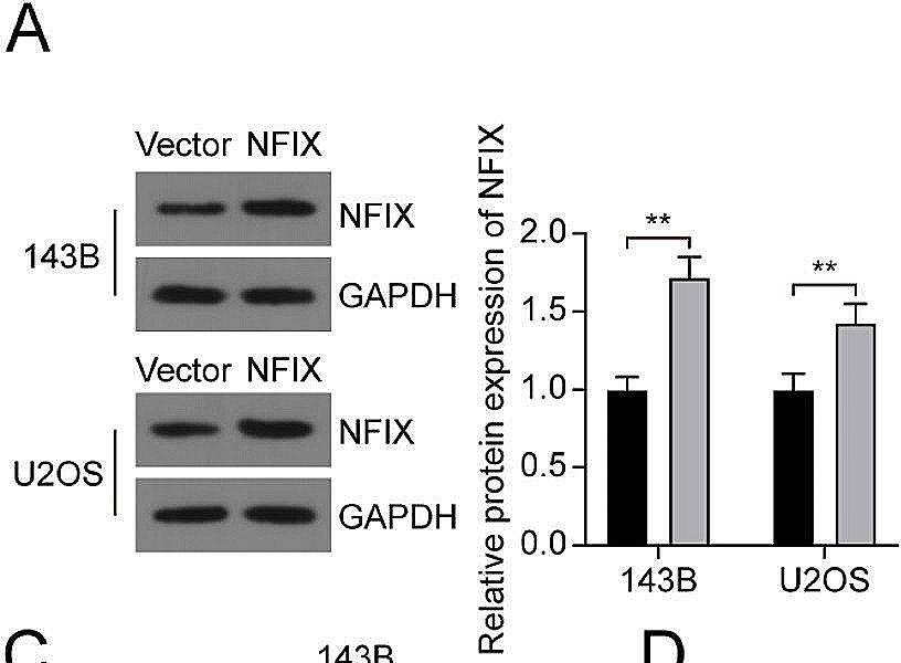 NFIX neutralized the effects of miR-744-5p on osteosarcoma cells. (A) Protein expression of NFIX in OS cells transfected with NFIX overexpression vector. (B) Protein expression of NFIX in different groups of OS cells. (C) OS cell viability was assessed by CCK-8 assay. (D) Cell proliferation was visualized by colony formation assay. (E) Flow cytometry assay was performed to determine cell apoptosis rate. (F) The viability of HUVECs was assessed by CCK-8 assay. (G) The effects of miR-744-5p and NFIX on the tube formation of HUVECs were detected by tube formation assay. *P < 0.05; ** P < 0.01 Image collected and cropped by CiteAb from the following open publication (//josr-online.biomedcentral.com/articles/10.1186/s13018-024-04947-x), licensed under a CC-BY license. Not internally tested by Novus Biologicals.