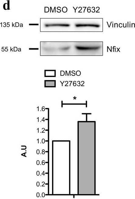 Nfix is expressed after phagocytosis and drive MP phenotypical switch. (a) Phagocytosis assay of M1 and M2c Nfixfl/fl and LysMCRE:Nfixfl/fl MPs cocultured 8h with apoptotic mpc. Representative FACS gate of phagocytotic M2c Nfixfl/fl and LysMCRE:Nfixfl/fl MPs (CD64+CellVue+) and percentage of phagocytotic M1 and M2c MPs coming from Nfixfl/fl and LysMCRE:Nfixfl/fl BMDM; (b) WT MPs were cocultured 16h with apoptotic mpcs. Representative FACS gate of non-phagocytotic (CD64+CellVue−) and phagocytotic (CD64+CellVue+) WT MPs. Quantification of Nfix expression realized by RT-qPCR on sorted non-phagocytotic and phagocytotic WT MPs and quantification of MPs positive for Nfix (Nfix+/F4/80+) realized by IF on non-phagocytotic and phagocytotic WT MPs; (c) WT MPs were cocultured for 16 h with apoptotic mpcs, with or without addition of Cytochalasin D. Quantification of F4/80+ MPs were positive for Nfix on a total of F4/80+ MPs; (d) Western blot of Nfix expression in WT MPs treated with DMSO (Dimethyl sulfoxide) or Y27632 for 16 h and quantification. Vinculin was used to normalize; (e) WT MPs were treated with DMSO or Y27632 for 16 h and were immunolabeled for pro-inflammatory markers (iNOS and TNF alpha ) and anti-inflammatory markers (TGF beta  and CD163). The number of positive cells is expressed as percentage out of total cells; (f) LysMCRE:Nfixfl/fl MPs were treated with DMSO or Y27632 for 16 h and were immunolabeled for pro-inflammatory markers (iNOS and TNF alpha ) and anti-inflammatory markers (TGF beta  and CD163). The number of positive cells is expressed as percentage out of total cells. * p < 0.05, *** p < 0.001. Results are means +/- SEM of at least three independent experiments. Image collected and cropped by CiteAb from the following open publication (//pubmed.ncbi.nlm.nih.gov/32183151), licensed under a CC-BY license. Not internally tested by Novus Biologicals.