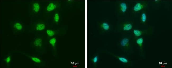 Oct4 antibody detects Oct4 protein at nucleus by immunofluorescent analysis.Sample: NT2D1 cells were fixed in 4% paraformaldehyde at RT for 15 min.Green: Oct4 protein stained by Oct4 antibody (NBP2-15053) diluted at 1:500.Blue: Hoechst 33342 staining.Scale bar = 10 um. 
