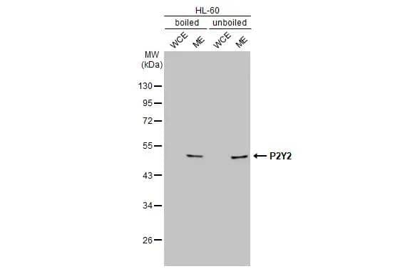 Boiled and unboiled HL-60 whole cell and membrane extracts (30 ug) were separated by 10% SDS-PAGE, and the membrane was blotted with P2Y2 antibody [N3C3] (NBP2-15060) diluted at 1:5000. The HRP-conjugated anti-rabbit IgG antibody  was used to detect the primary antibody. (WCE: whole cell extract; ME: membrane extract) 