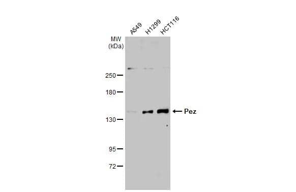 Various whole cell extracts (30 ug) were separated by 5% SDS-PAGE, and the membrane was blotted with Pez antibody [C2C3], C-term (NBP2-15069) diluted at 1:1000. The HRP-conjugated anti-rabbit IgG antibody  was used to detect the primary antibody. 