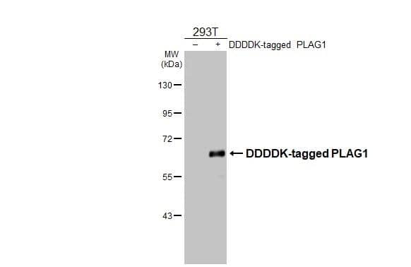 Non-transfected (-) and transfected (+) 293T whole cell extracts (30 ug) were separated by 7.5% SDS-PAGE, and the membrane was blotted with PLAG1 antibody (NBP2-15075) diluted at 1:2000. The HRP-conjugated anti-rabbit IgG antibody  was used to detect the primary antibody. 
