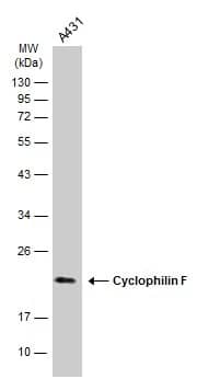 Western Blot: Cyclophilin-F Antibody [NBP2-15079] - Whole cell extract (30 ug) was separated by 12% SDS-PAGE, and the membrane was blotted with Cyclophilin-F antibody (NBP2-15079) diluted at 1:1000. The HRP-conjugated anti-rabbit IgG antibody  was used to detect the primary antibody.