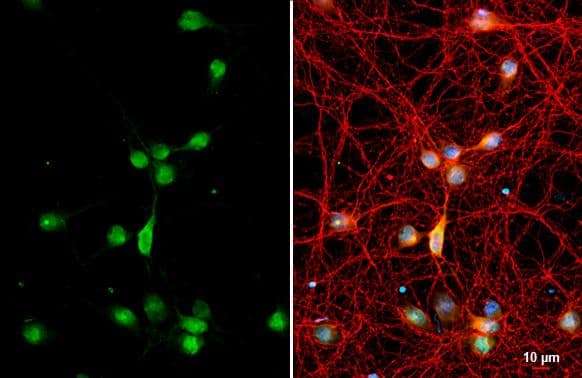 RAB11B antibody [N1C3] detects RAB11B protein by immunofluorescent analysis.Sample: DIV9 rat cortical neuron and Glia cell cells were fixed in 4% paraformaldehyde at RT for 15 min.Green: RAB11B stained by RAB11B antibody [N1C3] (NBP2-15085) diluted at 1:250.Red: Tau, an axon marker, stained by Tau antibody [GT287]  diluted at 1:500.Blue: Fluoroshield with DAPI . 
