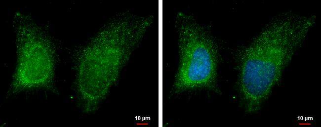 GRAMD1B antibody [C1C2], Internal detects GRAMD1B protein at cytoplasm by immunofluorescent analysis.Sample: HeLa cells were fixed in 2% paraformaldehyde at RT for 15 min.Green: GRAMD1B protein stained by GRAMD1B antibody [C1C2], Internal (NBP2-15085) diluted at 1:500.Blue: Hoechst 33342 staining. 
