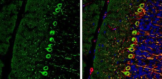 RAB11B antibody [N1C3] detects RAB11B Protein expression by immunohistochemical analysis.Sample: Frozen-sectioned adult mouse cerebellum. Green: RAB11B stained by RAB11B antibody [N1C3] (NBP2-15085) diluted at 1:250.Red: NF-H, stained by NF-H antibody [GT114]  diluted at 1:500.Blue: Fluoroshield with DAPI . br>Antigen Retrieval: Citrate buffer, pH 6.0, 10 min 