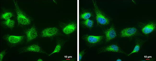 RAP antibody [N1C3] detects RAP protein at cytoplasm by immunofluorescent analysis.Sample: HeLa cells were fixed in 4% paraformaldehyde at RT for 15 min.Green: RAP protein stained by RAP antibody [N1C3] (NBP2-15088) diluted at 1:200.Blue: Hoechst 33342 staining.Scale bar = 10 um. 