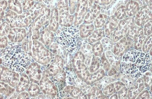 Immunohistochemistry-Paraffin: Ribosomal Protein L24 Antibody [NBP2-15102] - Ribosomal Protein L24 antibody detects Ribosomal Protein L24 protein at cytoplasm by immunohistochemical analysis.Sample: Paraffin-embedded mouse kidney.Ribosomal Protein L24 stained by Ribosomal Protein L24 antibody (NBP2-15102) diluted at 1:500.Antigen Retrieval: Tris-EDTA buffer, pH 9.0, 15 min