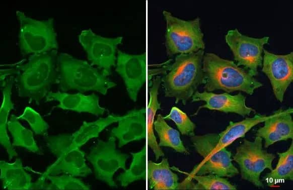 Immunocytochemistry/ Immunofluorescence: Ribosomal Protein L24 Antibody [NBP2-15102] - Ribosomal Protein L24 antibody detects Ribosomal Protein L24 protein at cytoplasm by immunofluorescent analysis.Sample: HeLa cells were fixed in 4% paraformaldehyde at RT for 15 min.Green: Ribosomal Protein L24 stained by Ribosomal Protein L24 antibody (NBP2-15102) diluted at 1:200.Red: alpha Tubulin, a cytoskeleton marker, stained by alpha Tubulin antibody [GT114]  diluted at 1:1000.Blue: Fluoroshield with DAPI .