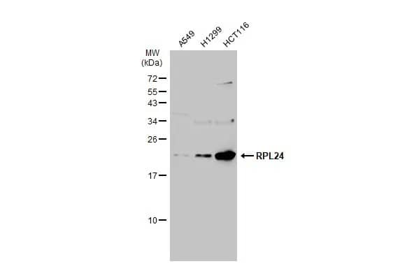 Western Blot: Ribosomal Protein L24 Antibody [NBP2-15102] - Various whole cell extracts (30 ug) were separated by 15% SDS-PAGE, and the membrane was blotted with Ribosomal Protein L24 antibody (NBP2-15102) diluted at 1:1000. The HRP-conjugated anti-rabbit IgG antibody  was used to detect the primary antibody.