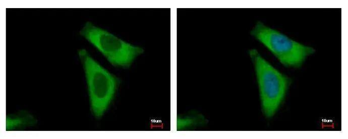 RPL29 antibody detects RPL29 protein at cytoplasm by immunofluorescent analysis. Sample: HeLa cells were fixed in 4% paraformaldehyde at RT for 15 min.Green: RPL29 protein stained by RPL29 antibody (NBP2-15103) diluted at 1:500.Blue: Hoechst 33343 staining. 