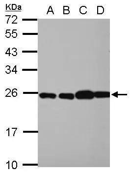 Sample (30 ug of whole cell lysate)  A: NT2D1  B: PC-3  C: U87-MG  D: SK-N-SH  12% SDS PAGE  NBP2-15103 diluted at 1:10000  
