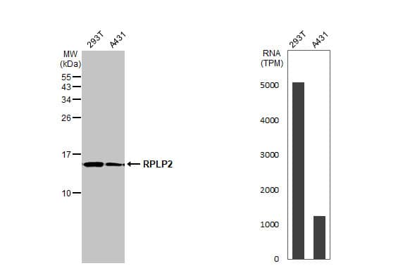 Western Blot RPLP2 Antibody