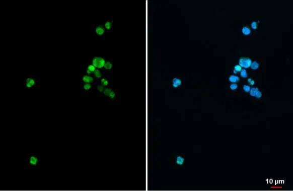 Immunocytochemistry/ Immunofluorescence: SATB1 Antibody [NBP2-15107] - SATB1 antibody [C2C3], C-term detects SATB1 protein at nucleus by immunofluorescent analysis.Sample: Jurkat cells were fixed in 4% paraformaldehyde at RT for 15 min.Green: SATB1  stained by SATB1 antibody [C2C3], C-term (NBP2-15107) diluted at 1:500.Blue: Fluoroshield with DAPI .