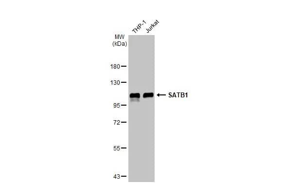 Western Blot: SATB1 Antibody [NBP2-15107] - Various whole cell extracts (30 ug) were separated by 7.5% SDS-PAGE, and the membrane was blotted with SATB1 antibody [C2C3], C-term (NBP2-15107) diluted at 1:40000. The HRP-conjugated anti-rabbit IgG antibody  was used to detect the primary antibody.