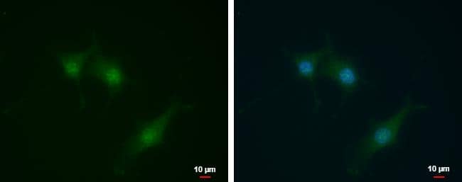SEC14L2 antibody [N1C1] detects SEC14L2 protein at cytoplasm and nucleus by immunofluorescent analysis.Sample: U87-MG cells were fixed in 4% paraformaldehyde at RT for 15 min.Green: SEC14L2 protein stained by SEC14L2 antibody [N1C1] (NBP2-15112) diluted at 1:500.Blue: Hoechst 33342 staining.Scale bar = 10 um. 