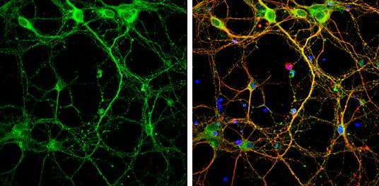 Syntaxin 3 antibody [N1C2] detects Syntaxin 3 protein by immunofluorescent analysis.Sample: DIV9 rat E18 primary cortical neurons were fixed in 4% paraformaldehyde at RT for 15 min.Green: Syntaxin 3 protein stained by Syntaxin 3 antibody [N1C2] (NBP2-15131) diluted at 1:500.Red: beta Tubulin 3/ Tuj1, stained by beta Tubulin 3/ Tuj1 antibody [GT11710]  diluted at 1:500.Blue: Fluoroshield with DAPI . 