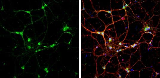 Syntaxin 6 antibody [N1C3] detects Syntaxin 6 protein at cytoplasm by immunofluorescent analysis.Sample: DIV9 rat E18 primary cortical neurons were fixed in 4% paraformaldehyde at RT for 15 min.Green: Syntaxin 6 protein stained by Syntaxin 6 antibody [N1C3] (NBP2-15132) diluted at 1:500.Red: beta Tubulin 3/ Tuj1, a neuron cell marker, stained by beta Tubulin 3/ Tuj1 antibody [GT11710]  diluted at 1:500.Blue: Fluoroshield with DAPI . 