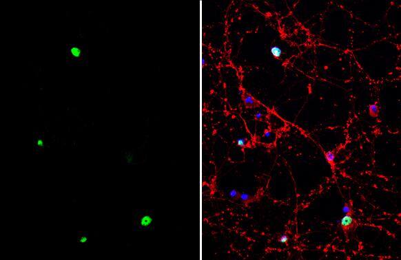 Immunocytochemistry/ Immunofluorescence TLE4 Antibody - BSA Free