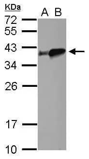 Western Blot: tropomyosin-4 Antibody [NBP2-15146] - Sample (30 ug of whole cell lysate)  A: zebrafish heart  B: zebrafish muscle  12% SDS PAGE  NBP2-15146 diluted at 1:500 