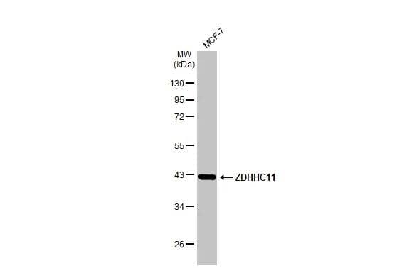 Western Blot ZDHHC11 Antibody - BSA Free
