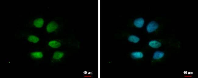 ZNF571 antibody [N1N2], N-term detects ZNF571 protein at nucleus by immunofluorescent analysis.Sample: NT2D1 cells were fixed in 4% paraformaldehyde at RT for 15 min.Green: ZNF571 protein stained by ZNF571 antibody [N1N2], N-term (NBP2-15176) diluted at 1:500.Blue: Hoechst 33342 staining. 