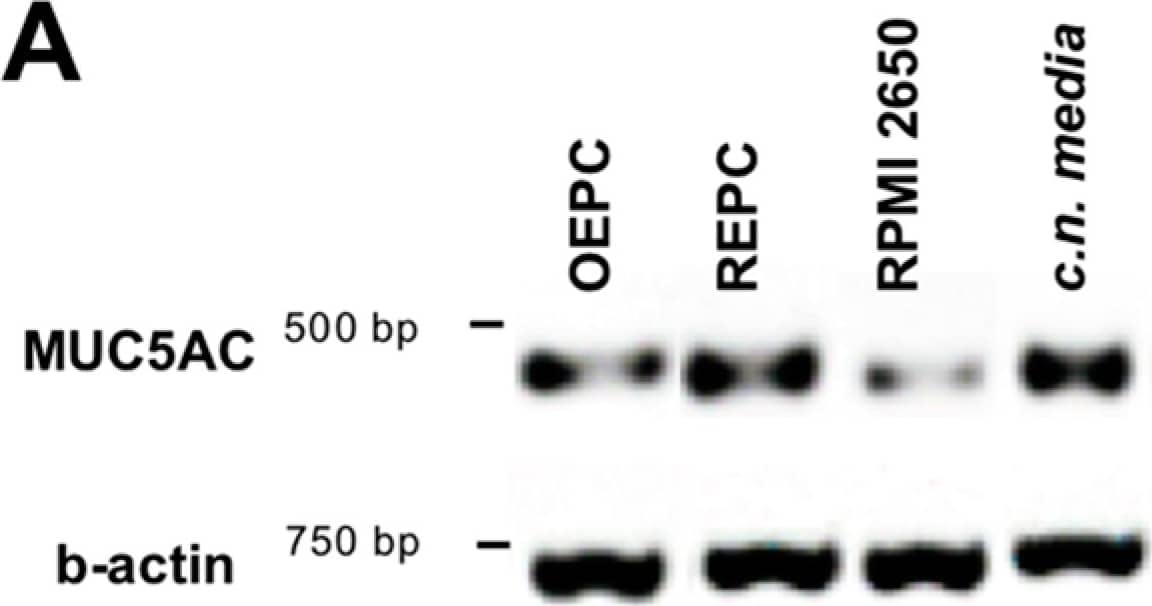 Dot Blot: MUC5AC Antibody (45M1) [NBP2-15196] - Mucin MUC5AC expression & immunoreactivity in primary cells of the nasal cavity. (A) Transcription analysis (RT-PCR) of MUC5AC gene in olfactory epithelial primary cells (OEPC), respiratory epithelial primary cells (REPC), tumour cell line RPMI 2650 & the concha nasalis media (c.n. media). MUC5AC transcript signal was referenced to beta-actin transcript signal. The significance was calculated by comparison of the OEPC, REPC & RPMI 2650 data with the c.n. media transcription data using an unpaired t-test. * p < 0.05; n = 4; error bars represent mean ± SD. (B) Dot blot analysis of MUC5AC protein in lysates of OEPC, REPC, RPMI 2650 & c.n. media. All OEPC & REPC cultures shown in (A,B) were cultivated for 14 days in vitro in T flasks. (C) Immunoreactivity against MUC5AC in OEPC that were first cultured for 7 days in T flask with a minimum confluency of 70% then under ALI conditions additional 20 days. Apically secreted mucus was collected at the days indicated corresponding to a mucin production of 2 to 3 days. Statistical analysis: unpaired t-test, * p < 0.05 compared to the standard model RPMI 2650. Image collected & cropped by CiteAb from the following publication (//pubmed.ncbi.nlm.nih.gov/31374872), licensed under a CC-BY license. Not internally tested by Novus Biologicals.