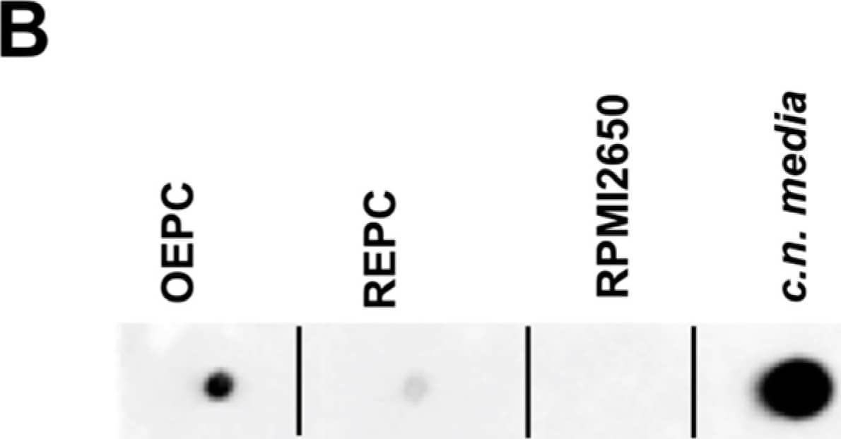 Dot Blot: MUC5AC Antibody (45M1) [NBP2-15196] - Mucin MUC5AC expression & immunoreactivity in primary cells of the nasal cavity. (A) Transcription analysis (RT-PCR) of MUC5AC gene in olfactory epithelial primary cells (OEPC), respiratory epithelial primary cells (REPC), tumour cell line RPMI 2650 & the concha nasalis media (c.n. media). MUC5AC transcript signal was referenced to beta-actin transcript signal. The significance was calculated by comparison of the OEPC, REPC & RPMI 2650 data with the c.n. media transcription data using an unpaired t-test. * p < 0.05; n = 4; error bars represent mean ± SD. (B) Dot blot analysis of MUC5AC protein in lysates of OEPC, REPC, RPMI 2650 & c.n. media. All OEPC & REPC cultures shown in (A,B) were cultivated for 14 days in vitro in T flasks. (C) Immunoreactivity against MUC5AC in OEPC that were first cultured for 7 days in T flask with a minimum confluency of 70% then under ALI conditions additional 20 days. Apically secreted mucus was collected at the days indicated corresponding to a mucin production of 2 to 3 days. Statistical analysis: unpaired t-test, * p < 0.05 compared to the standard model RPMI 2650. Image collected & cropped by CiteAb from the following publication (//pubmed.ncbi.nlm.nih.gov/31374872), licensed under a CC-BY license. Not internally tested by Novus Biologicals.